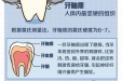 关于口腔健康的那些知识：