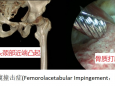 髋关节疼痛却无法明确病因？到山东大学齐鲁医院（青岛）运动医学科髋关节病微创治疗门诊试试