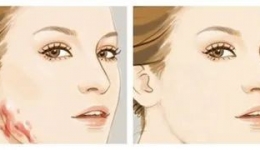 “疤”痕修复，你不知道的技巧。