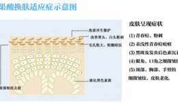 你不知道的刷酸指南