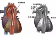 用心守护 | 我院心外科孙文宇教授团队“Y-型人工血管+转流”技术，为主动脉夹层患者保驾护航