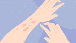 活动预告 | 我院核医学科将开展瘢痕疙瘩治疗公益活动