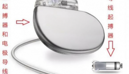 “大心脏、小机器”——无导线起搏器：解决患者心动过缓的法宝