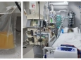 山东大学齐鲁医院（青岛）重症医学科成功开展双重血浆置换技术，为重症患者救治再添利器