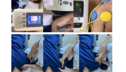 从久治不愈到康复有望，分期治疗“肩周炎”是关键！