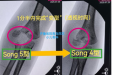 术业求精 | 我院小儿骨科突破新技术 超声辅助无切口手术治疗严重错位骨折获成功