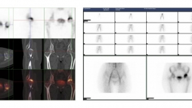 “关节炎”还是“老寒腿”？您的关节疼，可能根本不是一回事！
