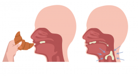 吃饭老呛咳、吞咽费力？这份“吞咽障碍居家训练指南”请收好！