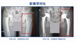 骨头可以存进 