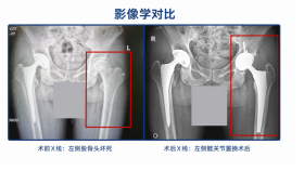 骨头可以存进 
